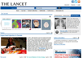 柳叶刀(The Lancet) 柳叶刀(The Lancet)